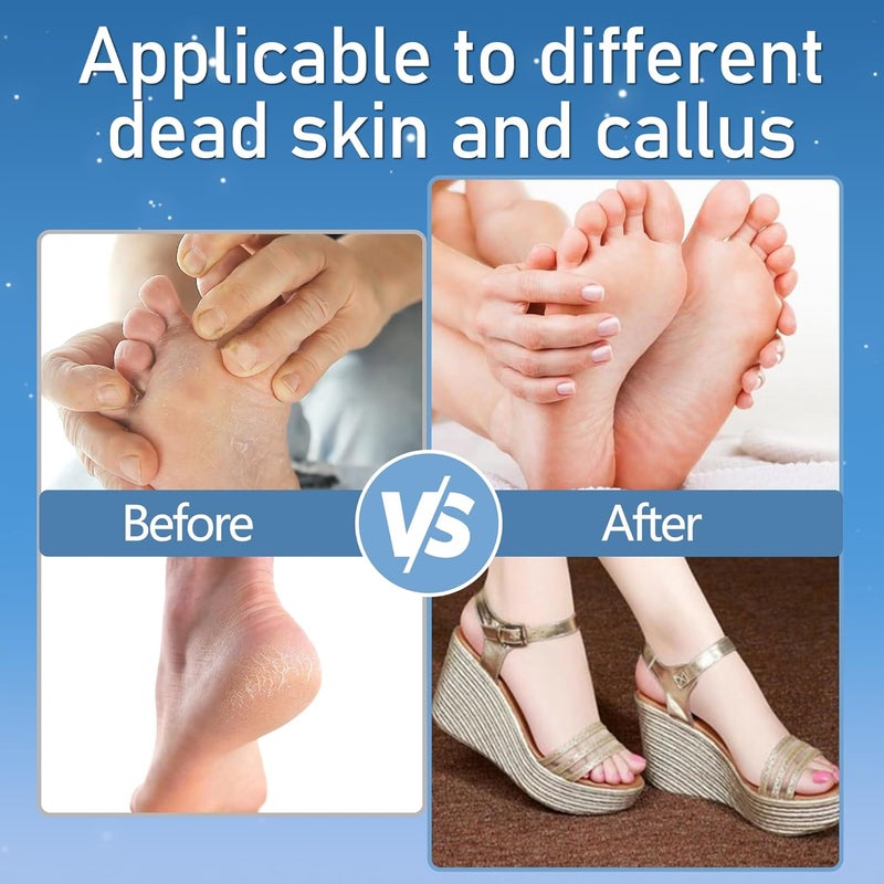 Jamestry Callus Remover for Feet, Electric Foot Callus Remover Waterproof with 3 Rollers 2 Speed Battery Display,17 in1 Rechargeable Foot File Pedicure Kits for Dead Hard Cracked Dry Skin - Image 4